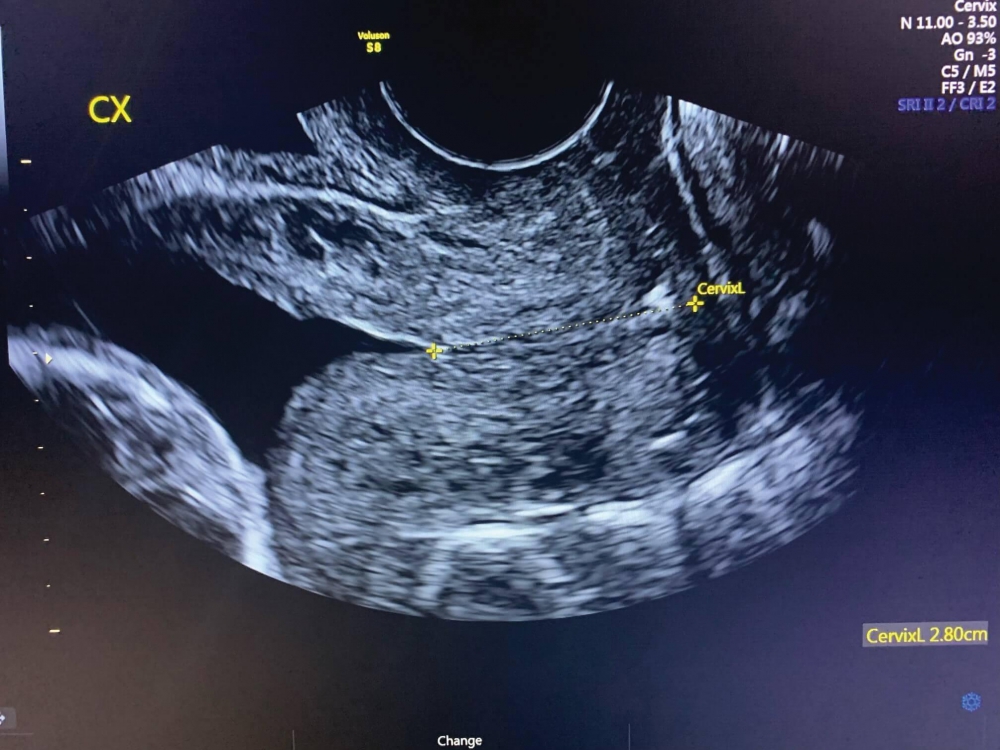 Image of January is Cervical Health Awareness Month